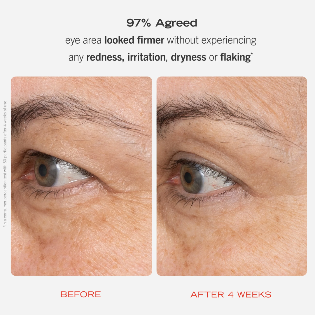 ANUA Retinol + Caffeine Eye Cream – Dark Circle, Puffiness & Wrinkle Treatment for Firmer, Brighter Eyes.
