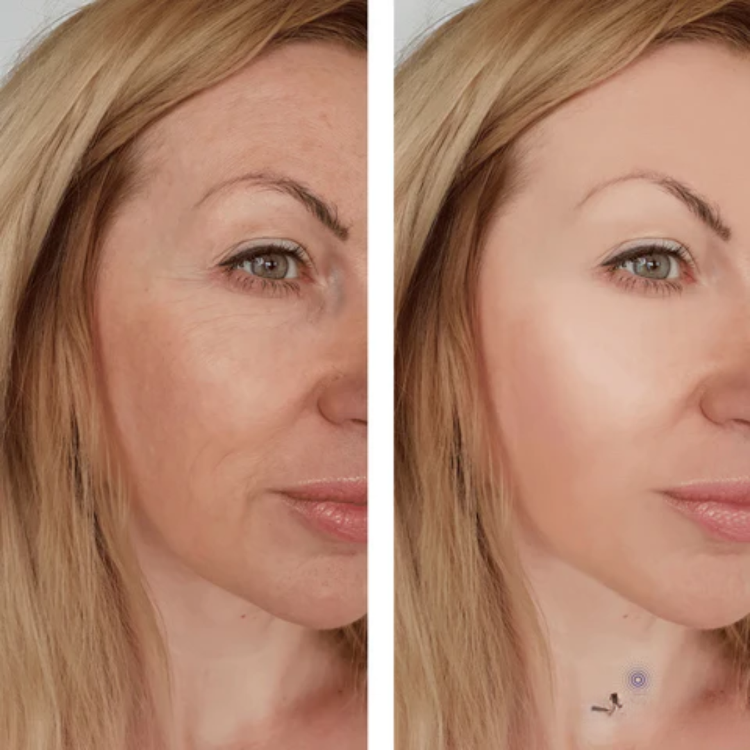 Clinique Even Better Makeup Broad Spectrum SPF 50 – 50% OFF – The Ultimate Glass Skin Luminous Glow – Zero Oil, Zero Shine – Evens, Corrects & Brightens – Deep Hydration, UV Protection & Oil Control