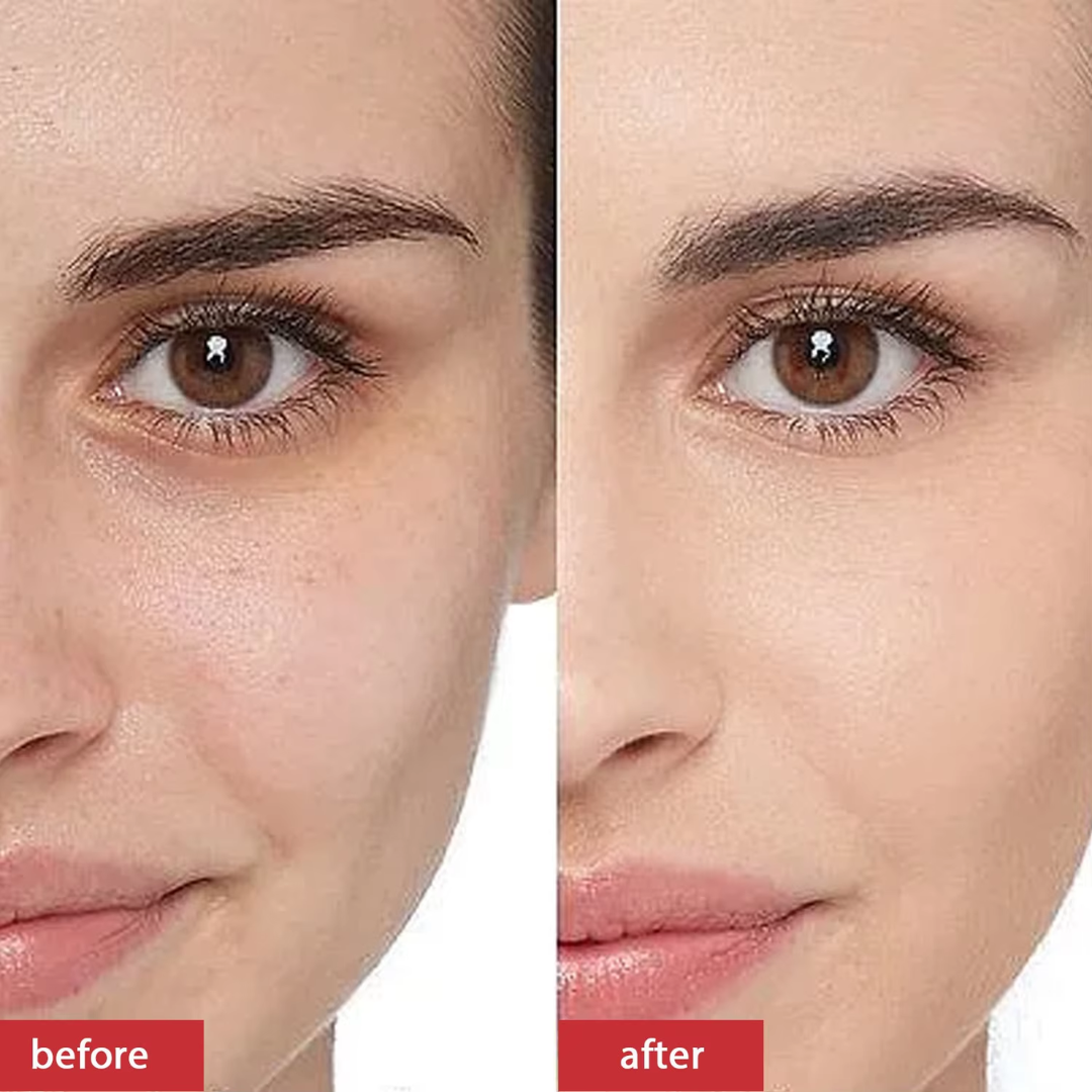 RENEE Immortal Face Cream | All-in-One Brightening & Anti-Aging Moisturizer | Repairs Skin Barrier, Hydrates, Evens Tone