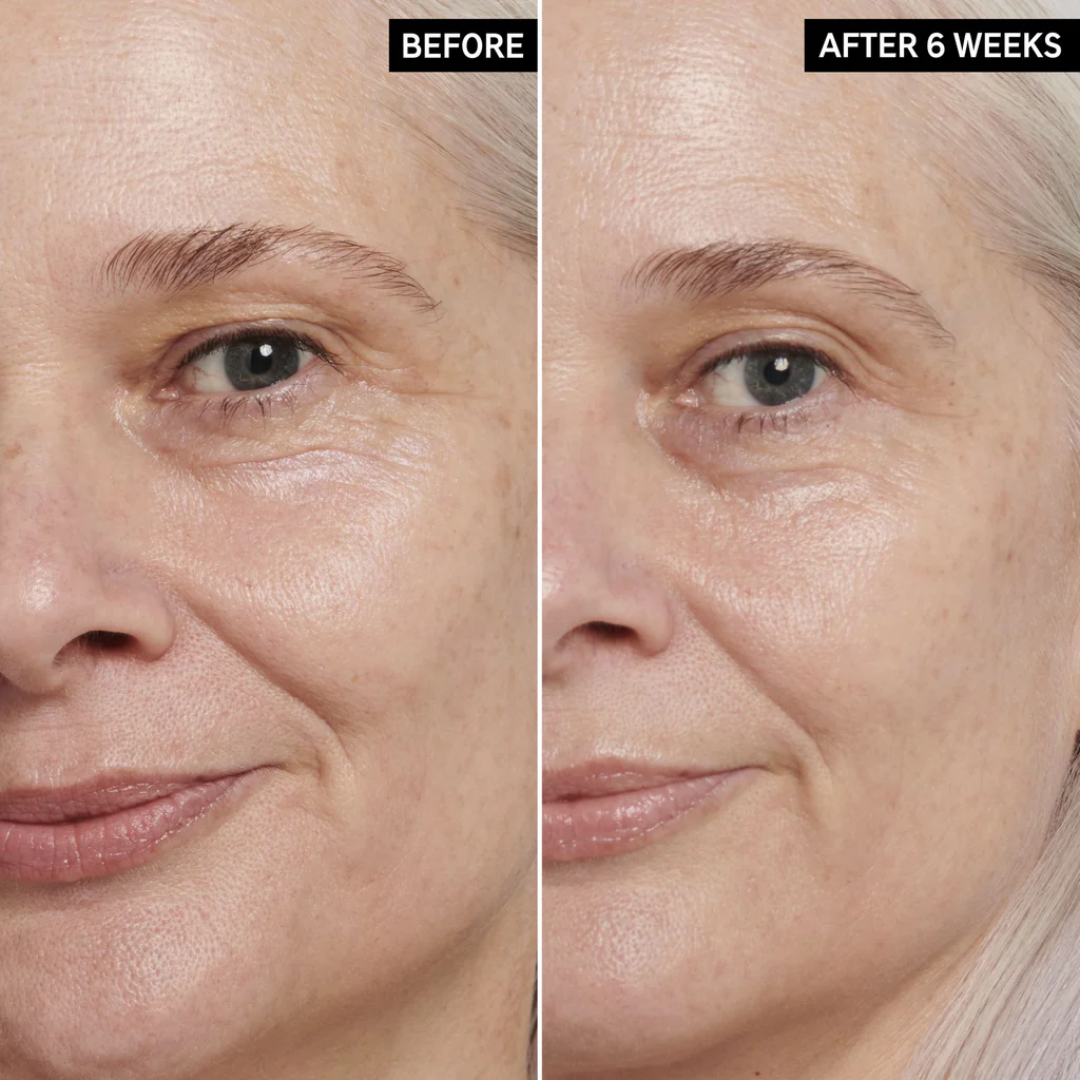 ANUA Retinol + Caffeine Eye Cream – Dark Circle, Puffiness & Wrinkle Treatment for Firmer, Brighter Eyes.