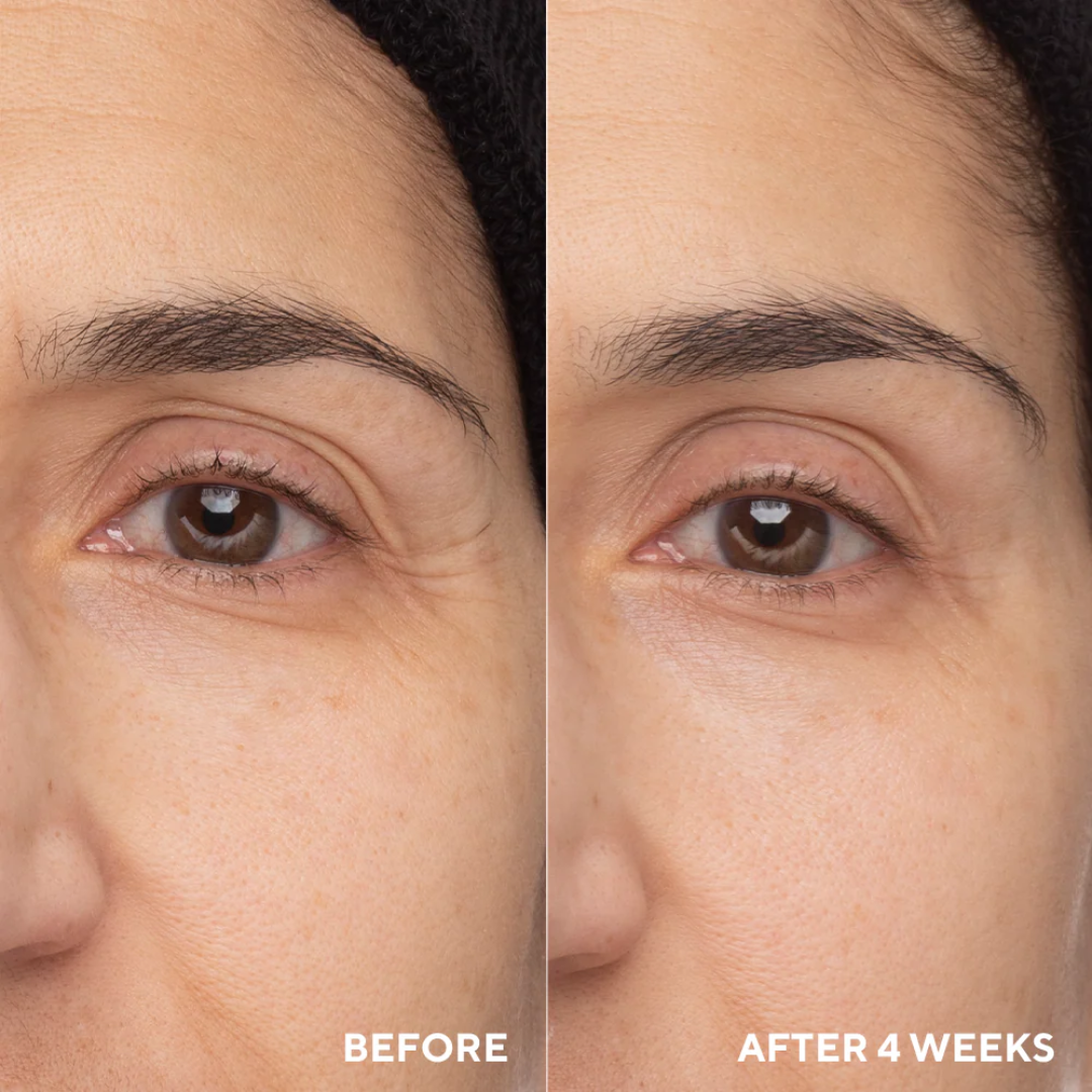 ANUA Retinol + Caffeine Eye Cream – Dark Circle, Puffiness & Wrinkle Treatment for Firmer, Brighter Eyes.