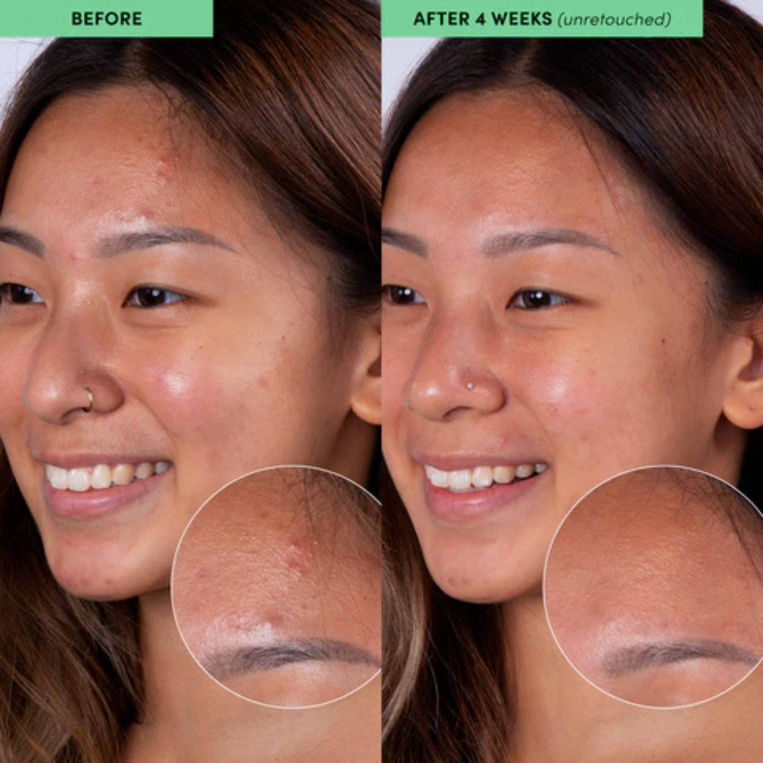 Beauty of Joseon Ground Rice and Honey Glow Mask | Gentle Exfoliation, Deep Hydration & Brightening Glow for All Skin Concerns