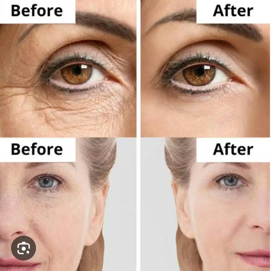 ANUA Retinol + Caffeine Eye Cream – Dark Circle, Puffiness & Wrinkle Treatment for Firmer, Brighter Eyes.