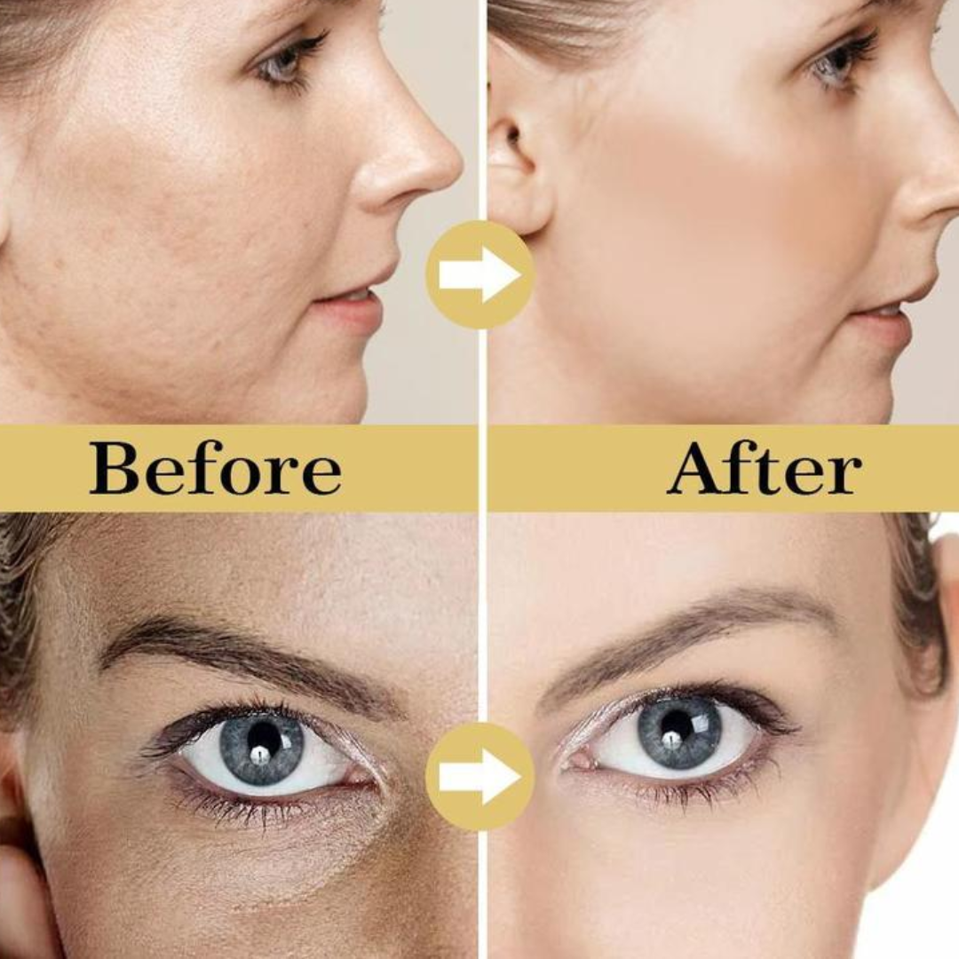 RENEE Immortal Face Cream | All-in-One Brightening & Anti-Aging Moisturizer | Repairs Skin Barrier, Hydrates, Evens Tone