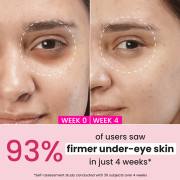 ANUA Retinol + Caffeine Eye Cream – Dark Circle, Puffiness & Wrinkle Treatment for Firmer, Brighter Eyes.
