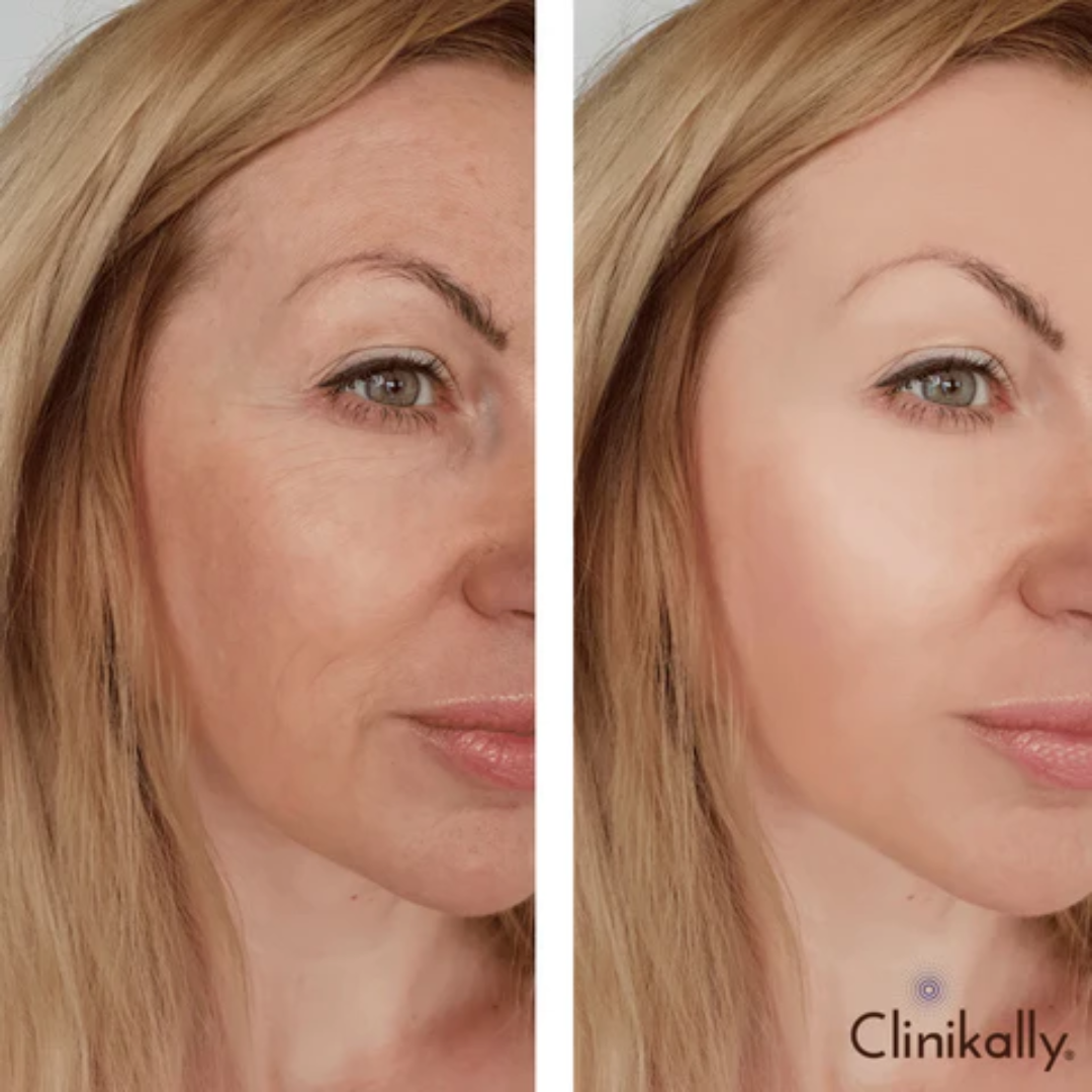 RENEE Immortal Face Cream | All-in-One Brightening & Anti-Aging Moisturizer | Repairs Skin Barrier, Hydrates, Evens Tone