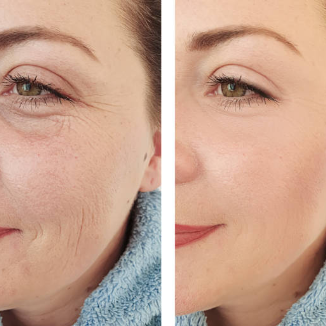 Calcium & Collagen Balm Stick | Remove Wrinkles, Smile Lines & Gives Hydration & Glow