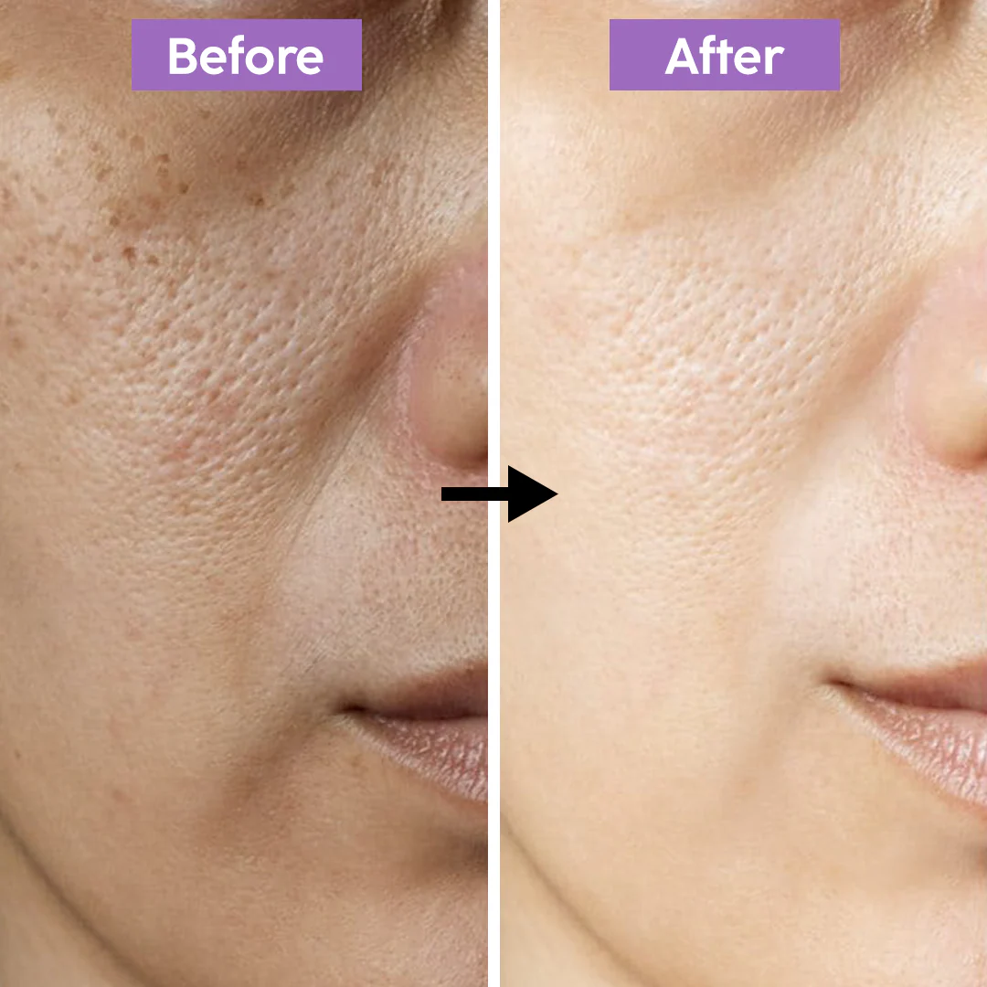 RENEE Immortal Face Cream | All-in-One Brightening & Anti-Aging Moisturizer | Repairs Skin Barrier, Hydrates, Evens Tone