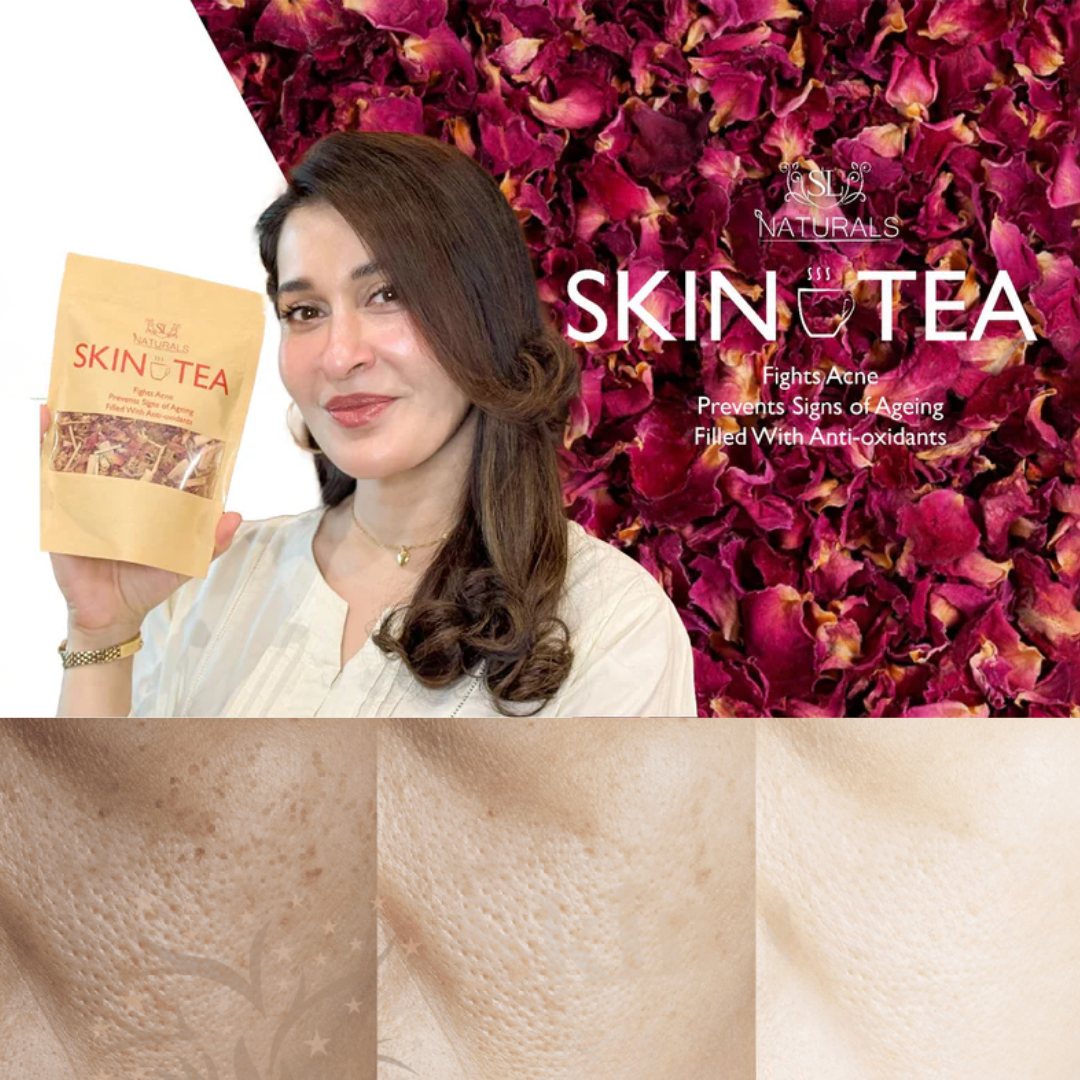 SL Naturals Skin Tea | Herbal Acne & Pigmentation Tea | 100% Natural Blend for Clear, Glowing Skin | Fights Acne, Reduces Pigmentation, Boosts Radiance