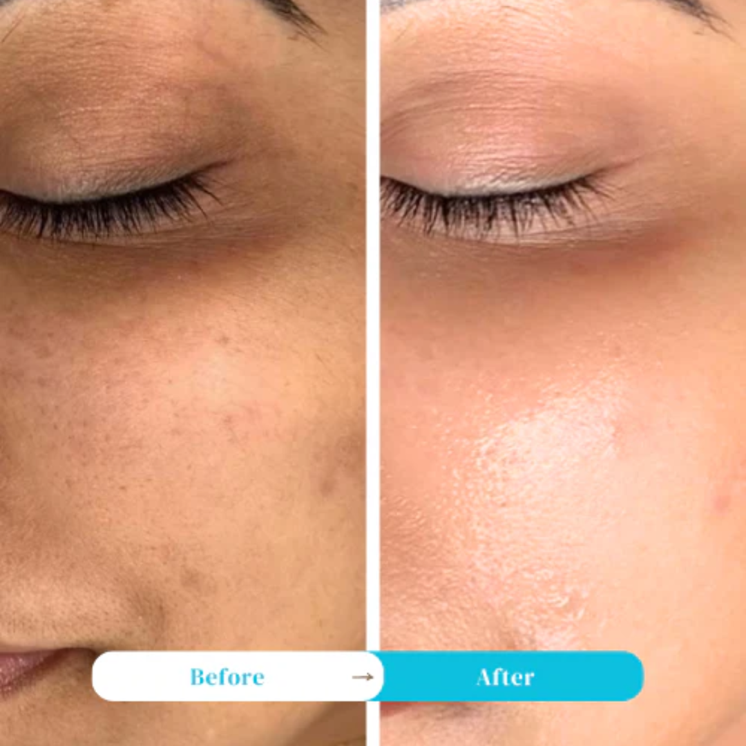 RENEE Immortal Face Cream | All-in-One Brightening & Anti-Aging Moisturizer | Repairs Skin Barrier, Hydrates, Evens Tone