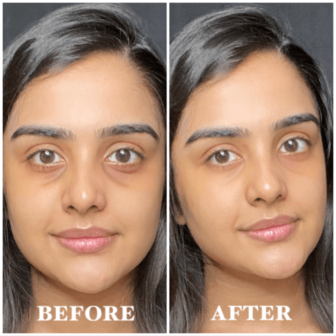 ANUA Retinol + Caffeine Eye Cream – Dark Circle, Puffiness & Wrinkle Treatment for Firmer, Brighter Eyes.