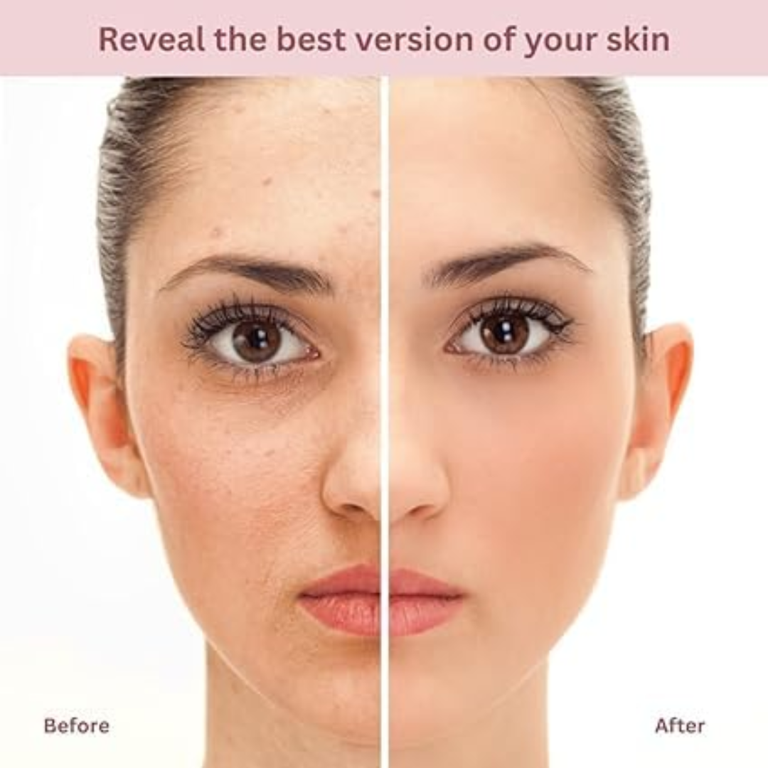 RENEE Immortal Face Cream | All-in-One Brightening & Anti-Aging Moisturizer | Repairs Skin Barrier, Hydrates, Evens Tone