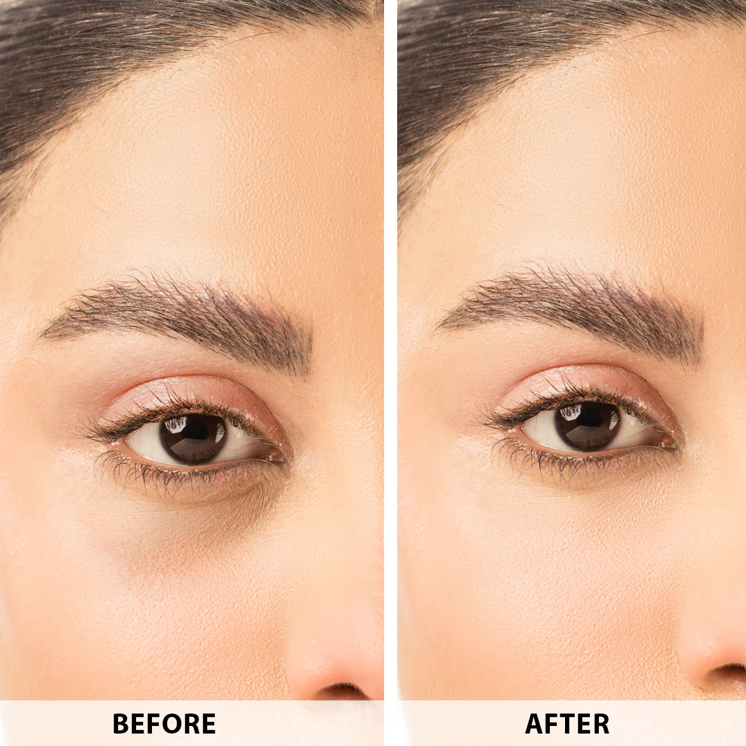 ANUA Retinol + Caffeine Eye Cream – Dark Circle, Puffiness & Wrinkle Treatment for Firmer, Brighter Eyes.
