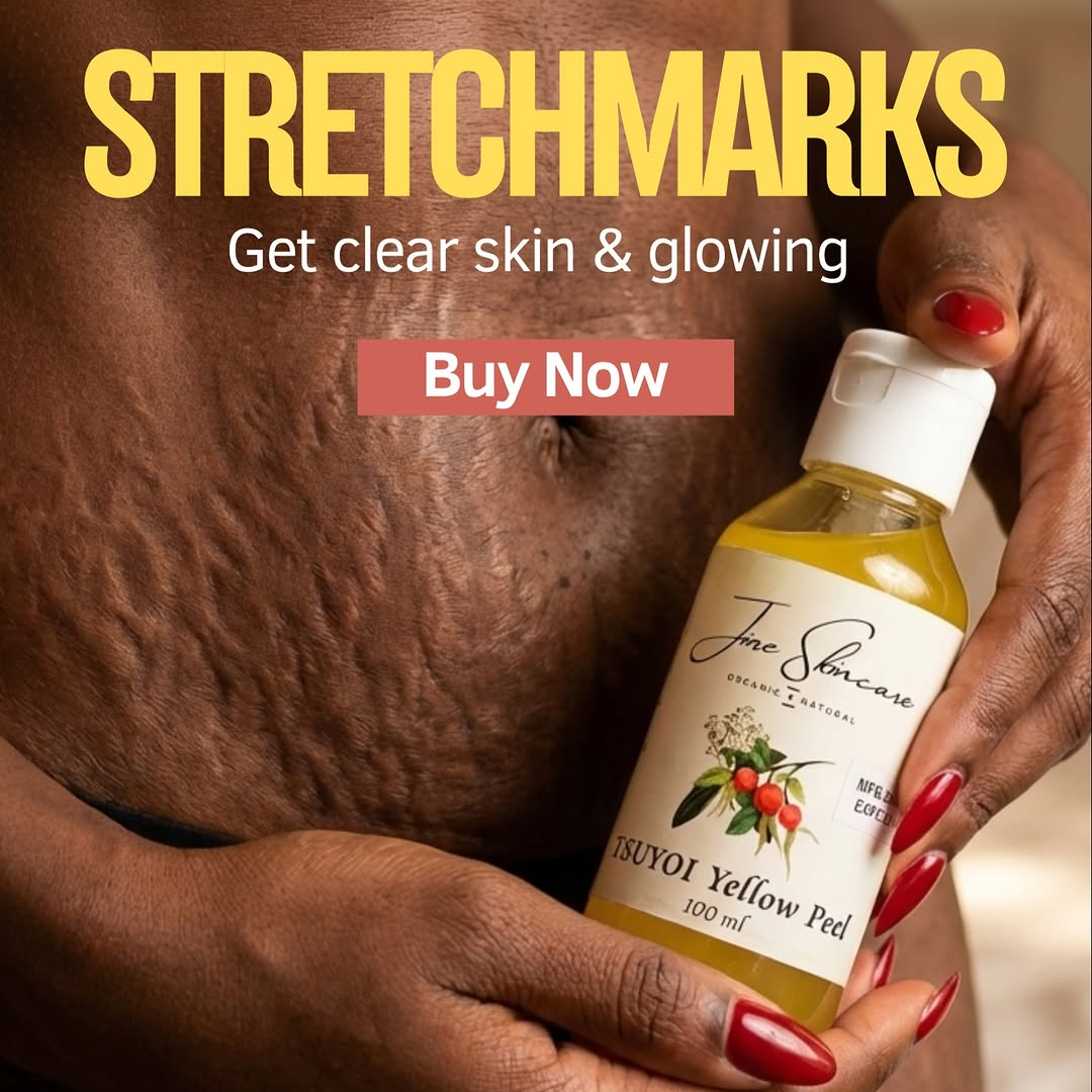 Jiore Tsuyoi Yellow Peel Body Oil | Organic & Natural with Kojic Acid, Turmeric, Thiotic Acid & AHA/BHA | Fades Stretch Marks, Peels Sun Tan & Brightens Skin