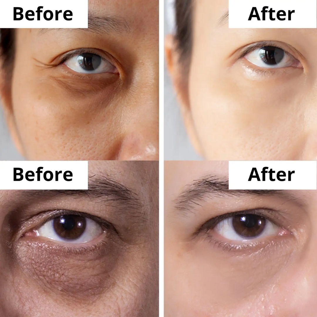 ANUA Retinol + Caffeine Eye Cream – Dark Circle, Puffiness & Wrinkle Treatment for Firmer, Brighter Eyes.