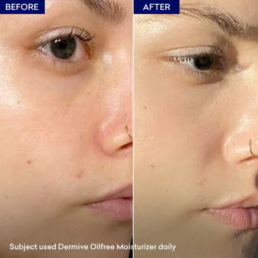Oil-Free Moisturizer - Quick absorb & instant glow + hydration
