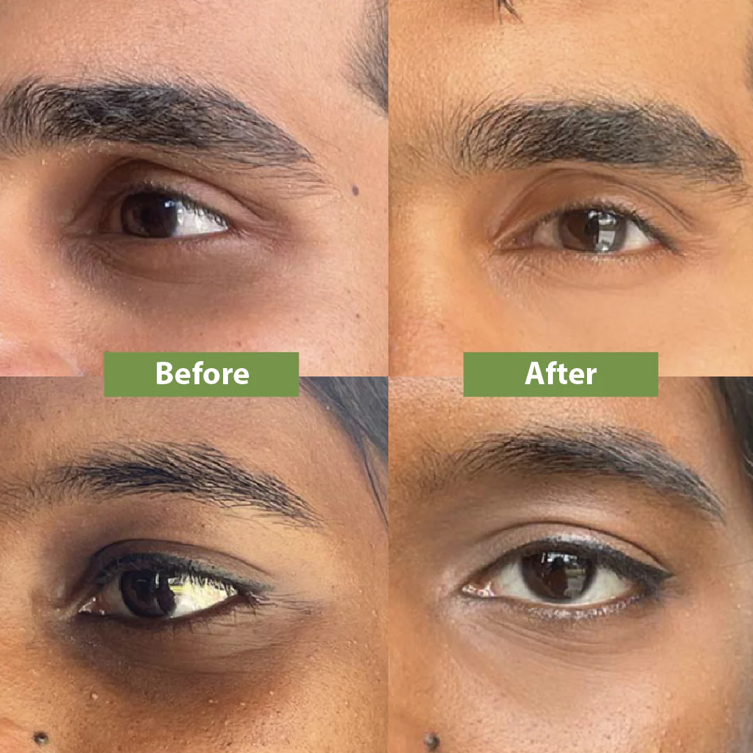 ANUA Retinol + Caffeine Eye Cream – Dark Circle, Puffiness & Wrinkle Treatment for Firmer, Brighter Eyes.