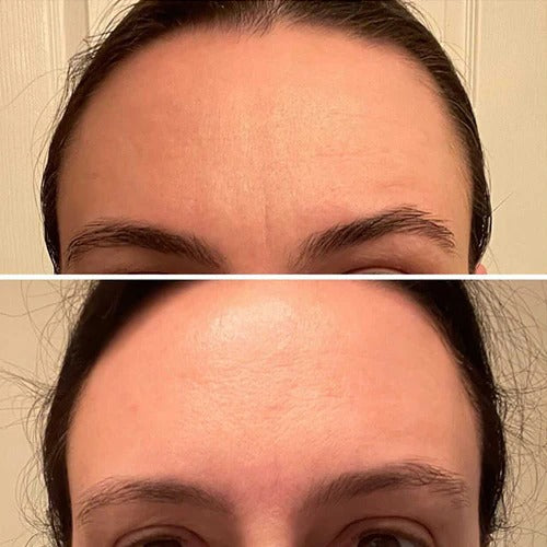 Lift, Tighten & Brighter - Celimax Retinal Glow boosting Cream